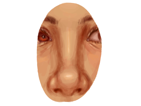 nose