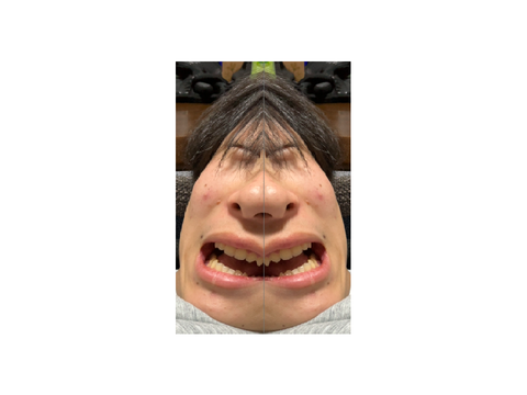 あ