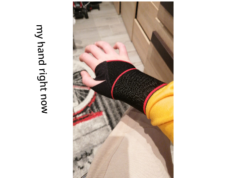 an accident