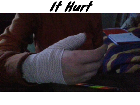 I fell Skiing 
