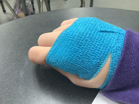 man i js scraped my hand