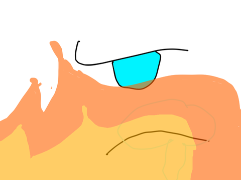 Part 17