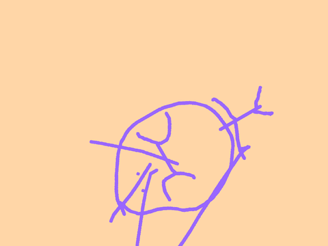 oh no remix-2 remix